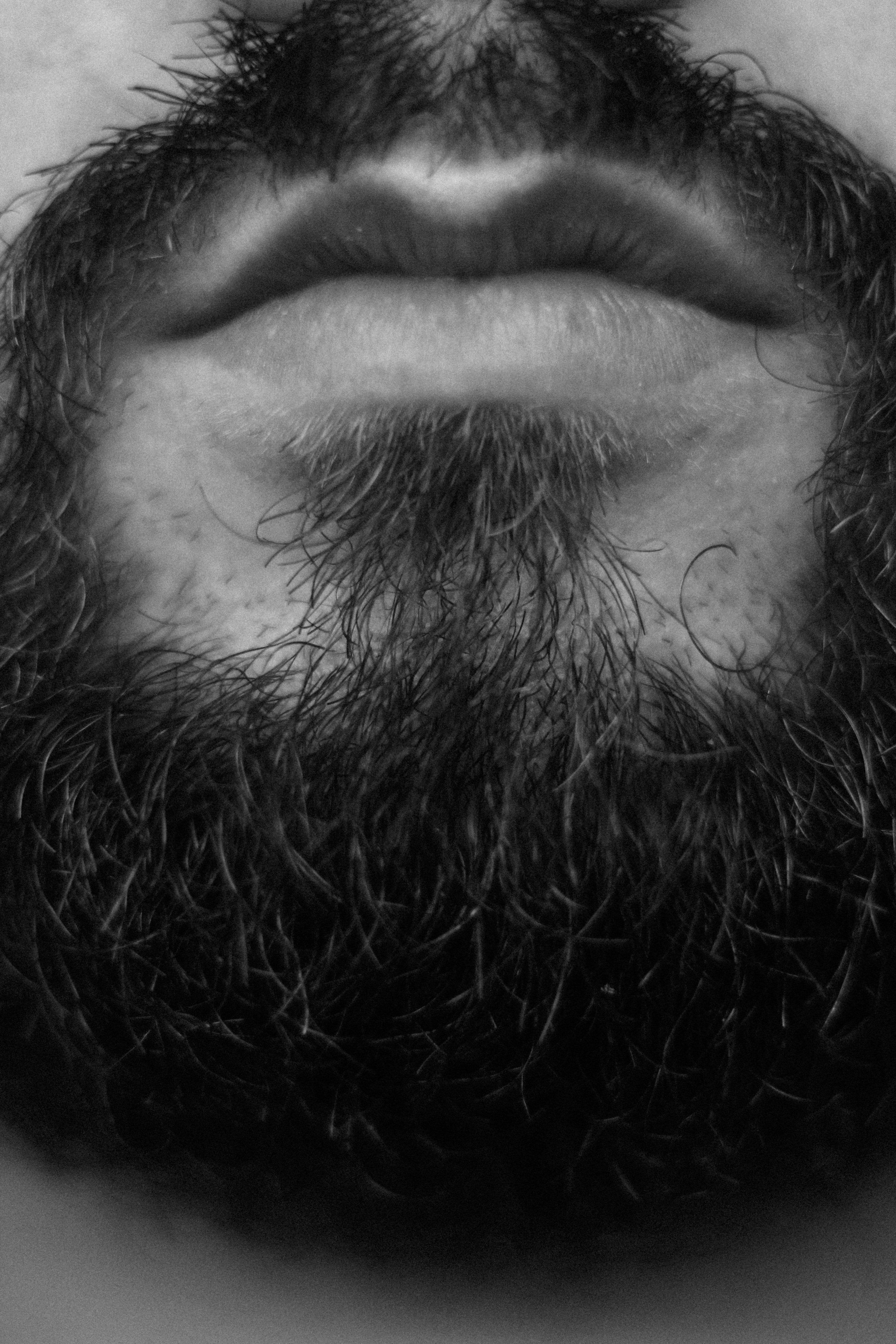How to Reduce Beard Dandruff